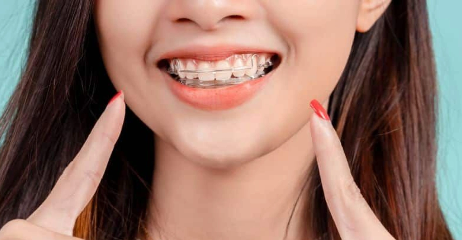 Retainer Care